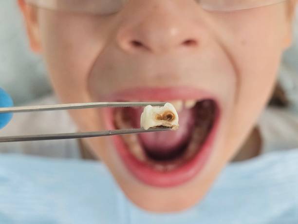 Best Pediatric Emergency Dentist in New Market, AL
